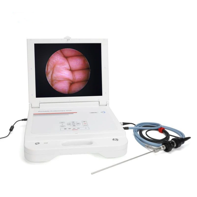 ENT Endoscope Camera System