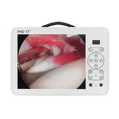Portable Endoscopic Surgical Camera